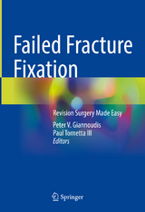 Failed Fracture Fixation - Giannoudis, Peter V.; Tornetta III, Paul