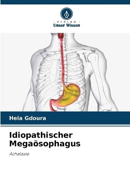 Idiopathischer Megaösophagus - Hela Gdoura