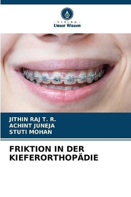 Friktion in Der Kieferorthopädie - Jithin Raj T R, ACHINT JUNEJA, Stuti Mohan