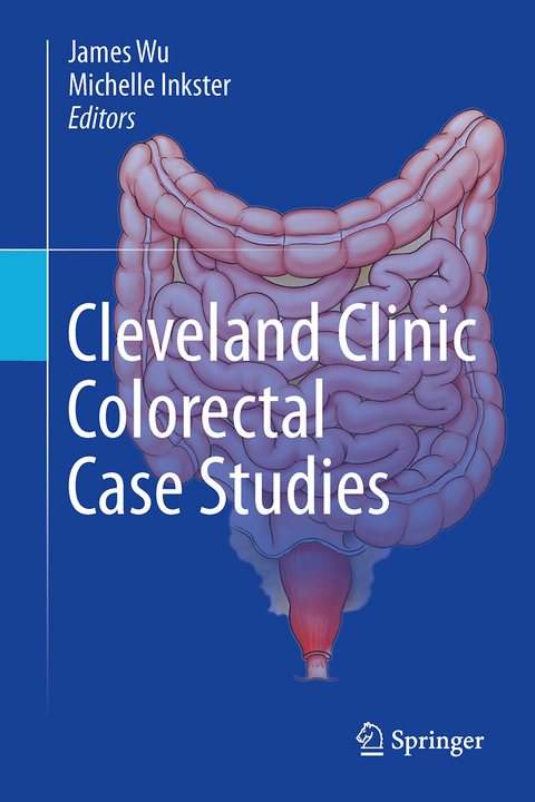 Cleveland Clinic Colorectal Case Studies - 
