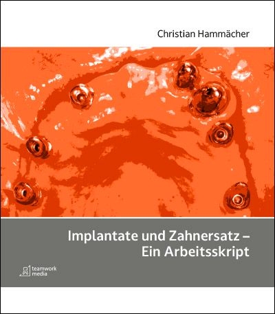 Implantate und Zahnersatz - Ein Arbeitsskript - Dr. Christian Hammächer