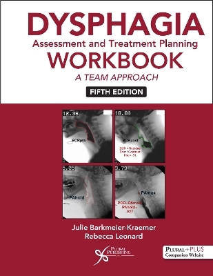 Dysphagia Assessment and Treatment Planning Workbook