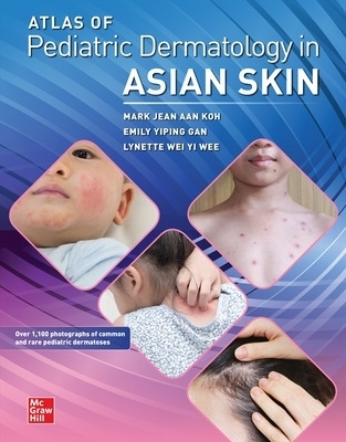 Atlas of Pediatric Dermatology in Asian Skin - Mark Jean Aan Koh, Emily Yiping Gan, Lynette Wie Yi Wee