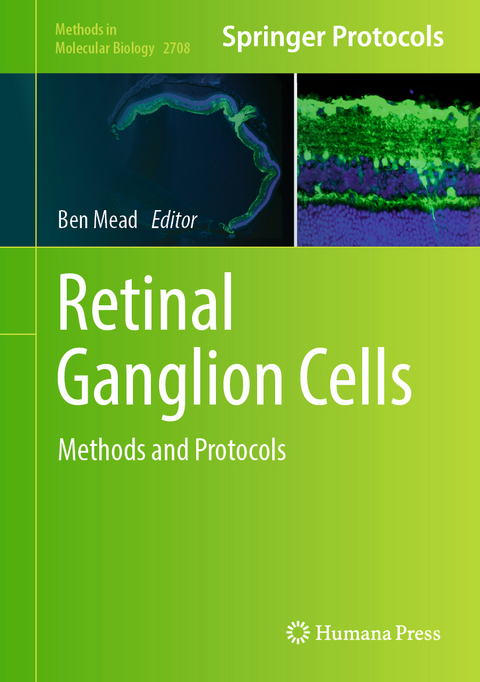 Retinal Ganglion Cells - 