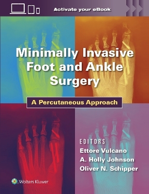 Minimally Invasive Foot and Ankle Surgery - Dr. Ettore Vulcano, Holly Johnson, Oliver Schipper