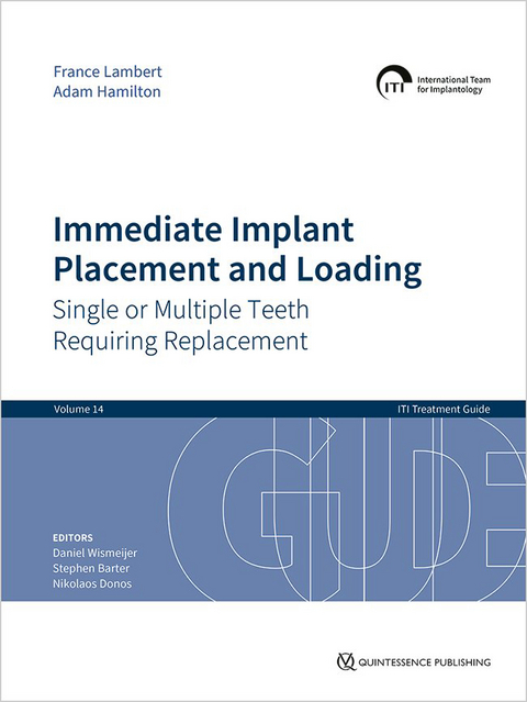 Immediate Implant Placement and Loading – Single or Multiple Teeth Requiring Replacement - France Lambert, Adam Hamilton