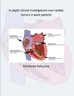 In-depth clinical investigations over cardiac tumors in adult patients - Mohamed Rahouma