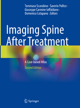 Imaging Spine After Treatment - Scarabino, Tommaso; Pollice, Saverio; Iaffaldano, Giuseppe Carmine; Catapano, Domenico