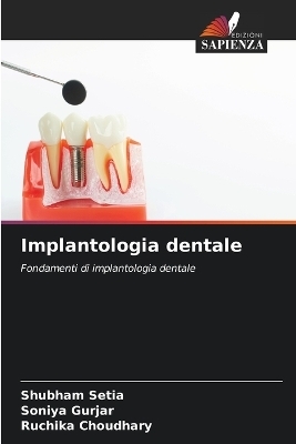 Implantologia dentale - Shubham Setia, Soniya Gurjar, Ruchika Choudhary