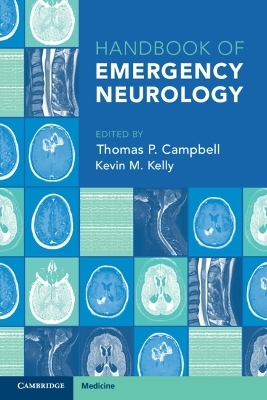 Handbook of Emergency Neurology - 