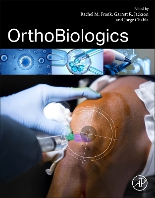 OrthoBiologics - 