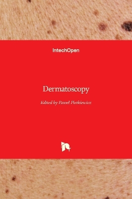 Dermatoscopy - 