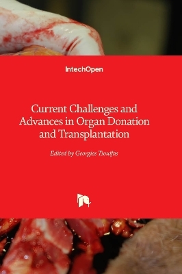 Current Challenges and Advances in Organ Donation and Transplantation - 