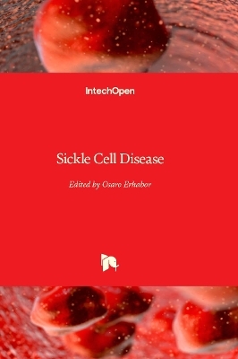 Sickle Cell Disease - 