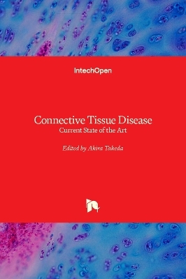 Connective Tissue Disease - 