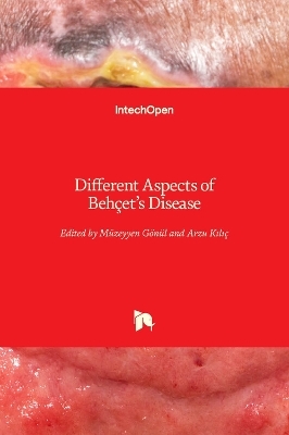 Different Aspects of Behçet's Disease - 