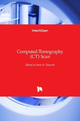 Computed-Tomography (CT) Scan - 