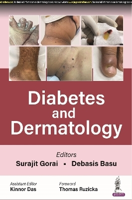 Diabetes and Dermatology - Surajit Gorai, Debasis Basu, Kinnor Das