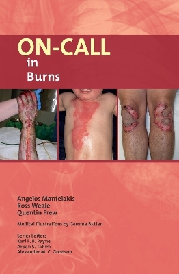 On-Call in Burns - Angelos Mantelakis, Ross Weale, Quentin Frew