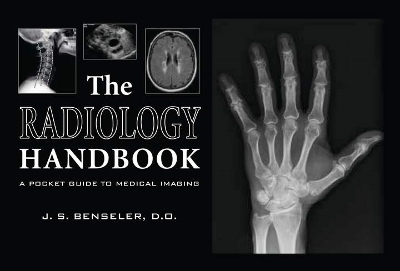 The Radiology Handbook - J. S. Benseler