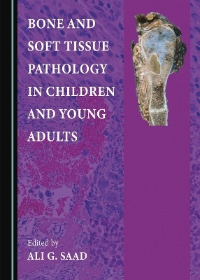 Bone and Soft Tissue Pathology in Children and Young Adults - Ali G. Saad