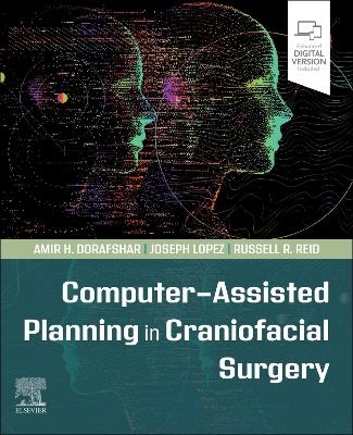 Computer-Assisted Planning in Craniofacial Surgery - Amir H Dorafshar, Joseph Lopez, RUSSELL R. REID