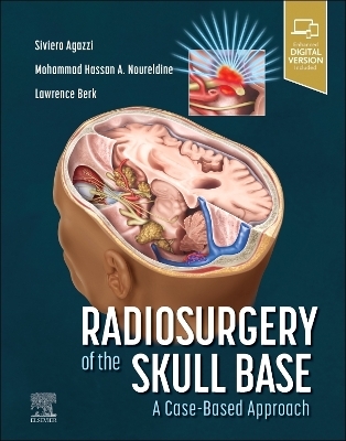Radiosurgery of the Skull Base: A Case-Based Approach - 