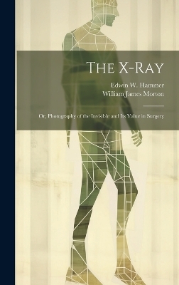 The X-Ray; Or, Photography of the Invisible and Its Value in Surgery - William James Morton, Edwin W Hammer