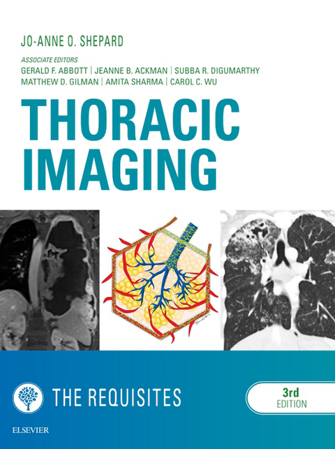 Thoracic Imaging The Requisites -  Jo-Anne O Shepard