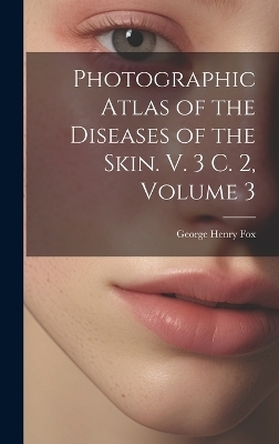 Photographic Atlas of the Diseases of the Skin. V. 3 C. 2, Volume 3 - George Henry Fox