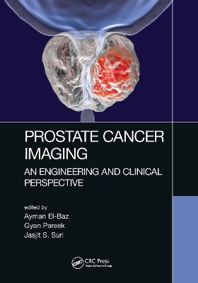 Prostate Cancer Imaging - 