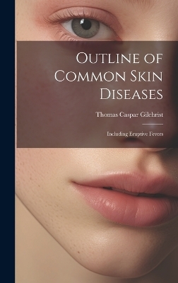 Outline of Common Skin Diseases - Thomas Caspar Gilchrist