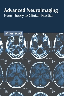 Advanced Neuroimaging: From Theory to Clinical Practice - 