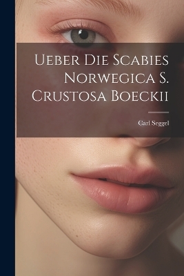 Ueber Die Scabies Norwegica S. Crustosa Boeckii - Carl Seggel