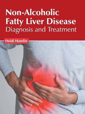 Non-Alcoholic Fatty Liver Disease: Diagnosis and Treatment - 