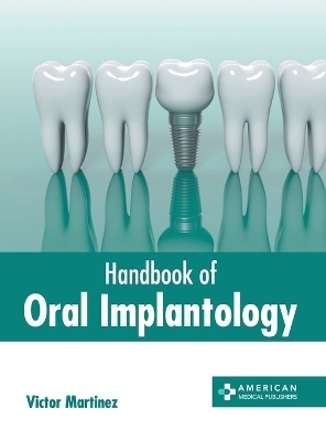 Handbook of Oral Implantology - 
