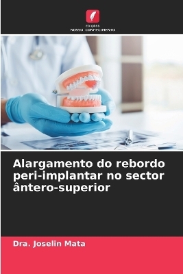 Alargamento do rebordo peri-implantar no sector ântero-superior - Dra Joselin Mata