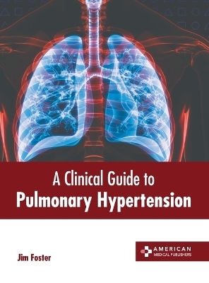 A Clinical Guide to Pulmonary Hypertension - 