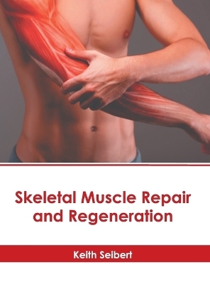 Skeletal Muscle Repair and Regeneration - 