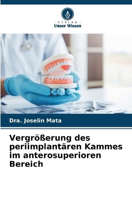 Vergrößerung des periimplantären Kammes im anterosuperioren Bereich - Dra Joselin Mata