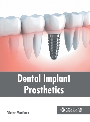 Dental Implant Prosthetics - 