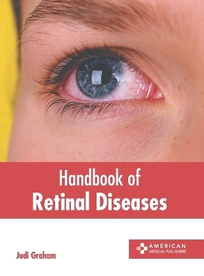 Handbook of Retinal Diseases - 