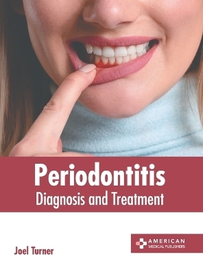 Periodontitis: Diagnosis and Treatment - 