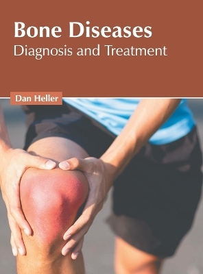 Bone Diseases: Diagnosis and Treatment - 