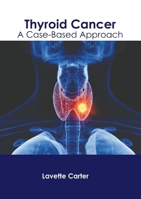 Thyroid Cancer: A Case-Based Approach - 