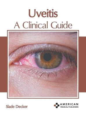 Uveitis: A Clinical Guide - 