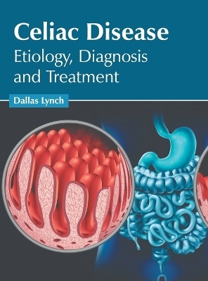 Celiac Disease: Etiology, Diagnosis and Treatment - 