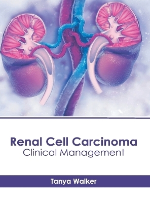 Renal Cell Carcinoma: Clinical Management - 