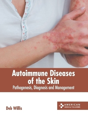 Autoimmune Diseases of the Skin: Pathogenesis, Diagnosis and Management - 