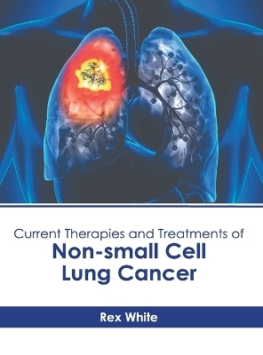 Current Therapies and Treatments of Non-Small Cell Lung Cancer - 